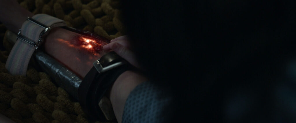 Una's wound glowing